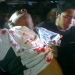 Senior citizen injured as stones, eggs hurled at PKR ceramah
